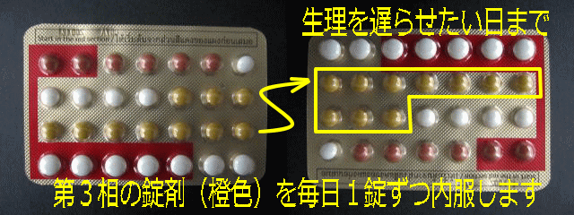 生理を遅らせる ピル以外